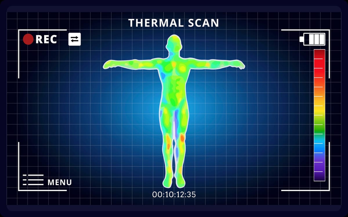 Thermographie infrarouge